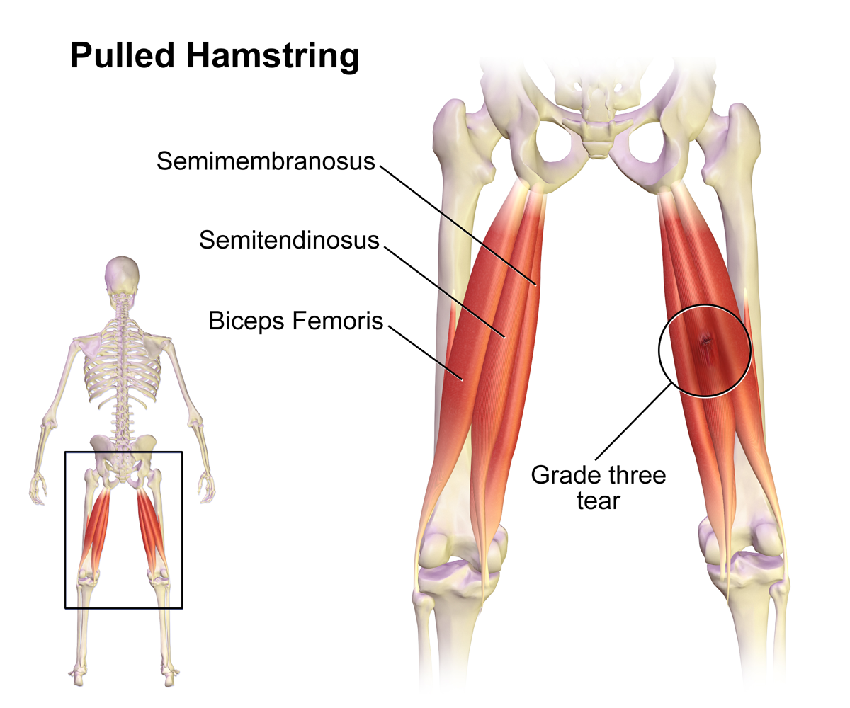 The 5 Best Hamstring Compression Sleeves A Helpful Guide from a PT