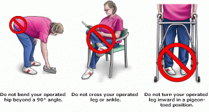 total hip precautions posterior approach