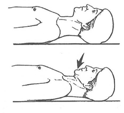 chin tuck shoulder pain