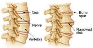 Neck Stiffness: A Helpful Guide to Manage Pain and Stiffness - Best ...