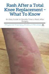 Rash After a Total Knee Replacement - What To Know