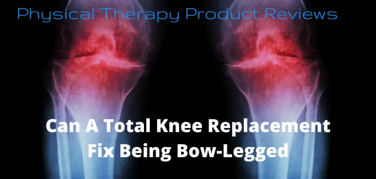 Can a Total Knee Replacement Fix Being Bow-Legged? - Best Physical ...