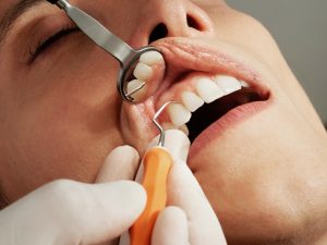 Avoid Dental Work