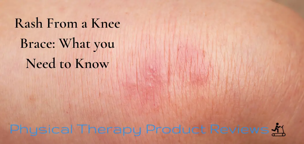 Rash From a Knee Brace What you Need to Know